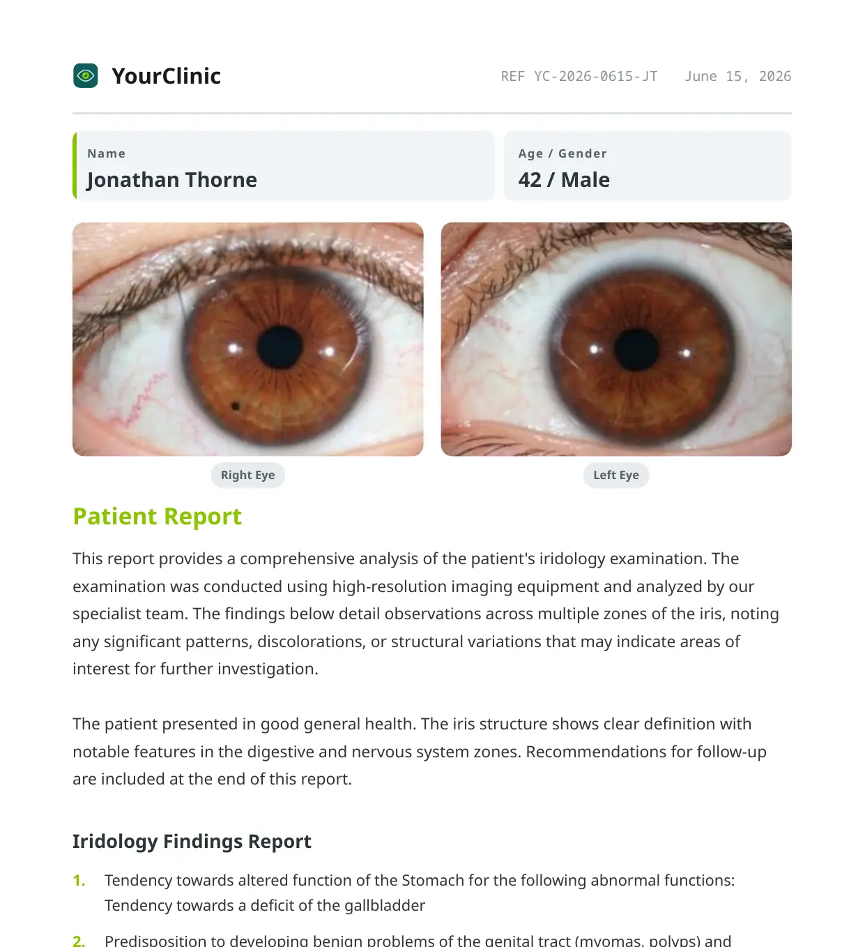 A branded CosmicIris patient report PDF: the clinic header and patient details above both iris photographs, followed by the written iridology findings.